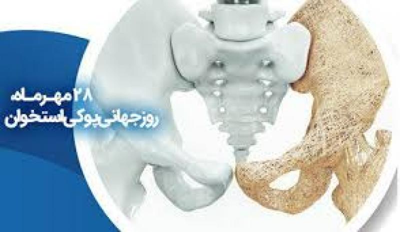 روز جهانی پوکی استخوان مهر {20 اکتبر } 1404